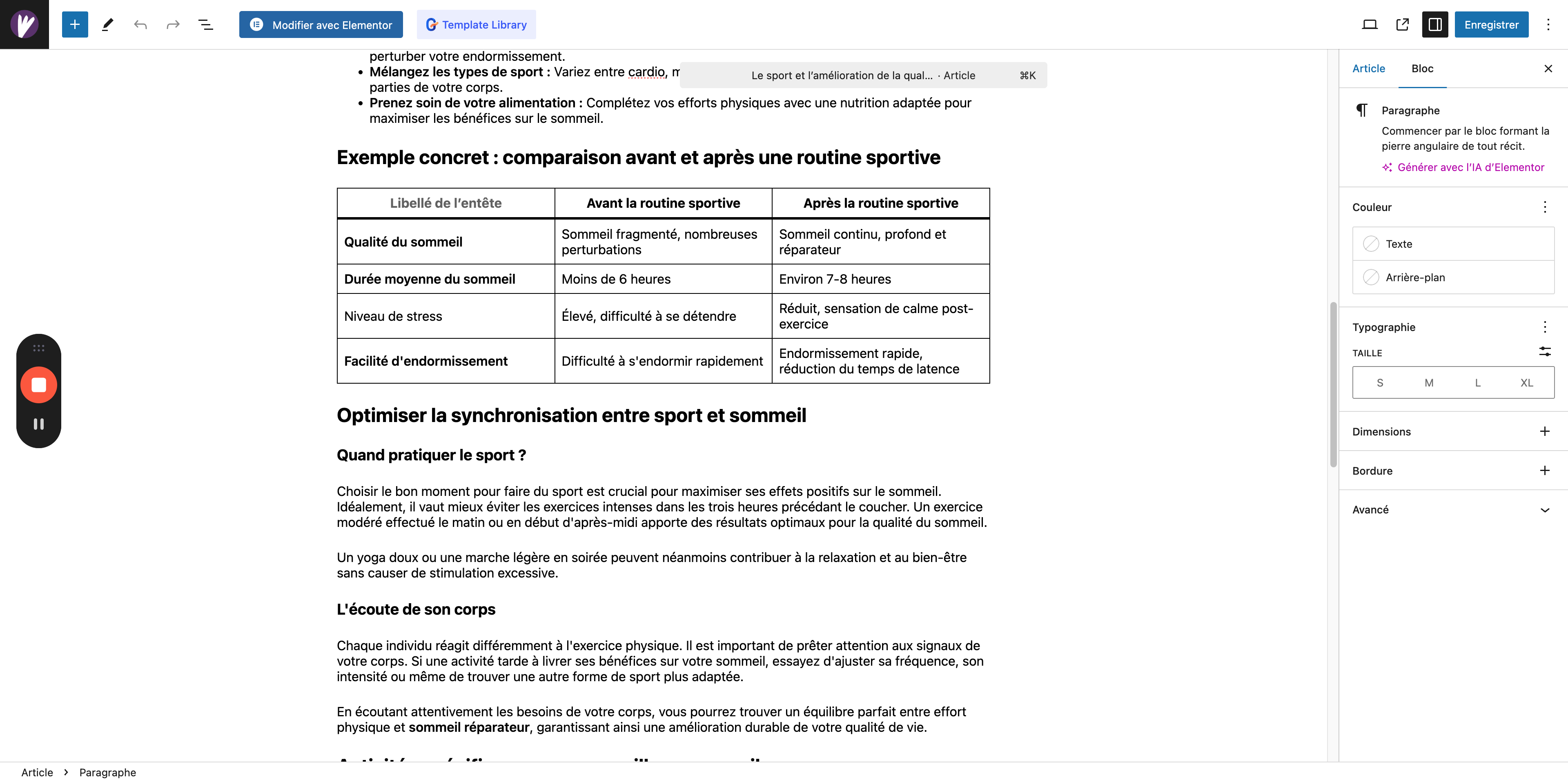 Step #11: Réglages d'un article