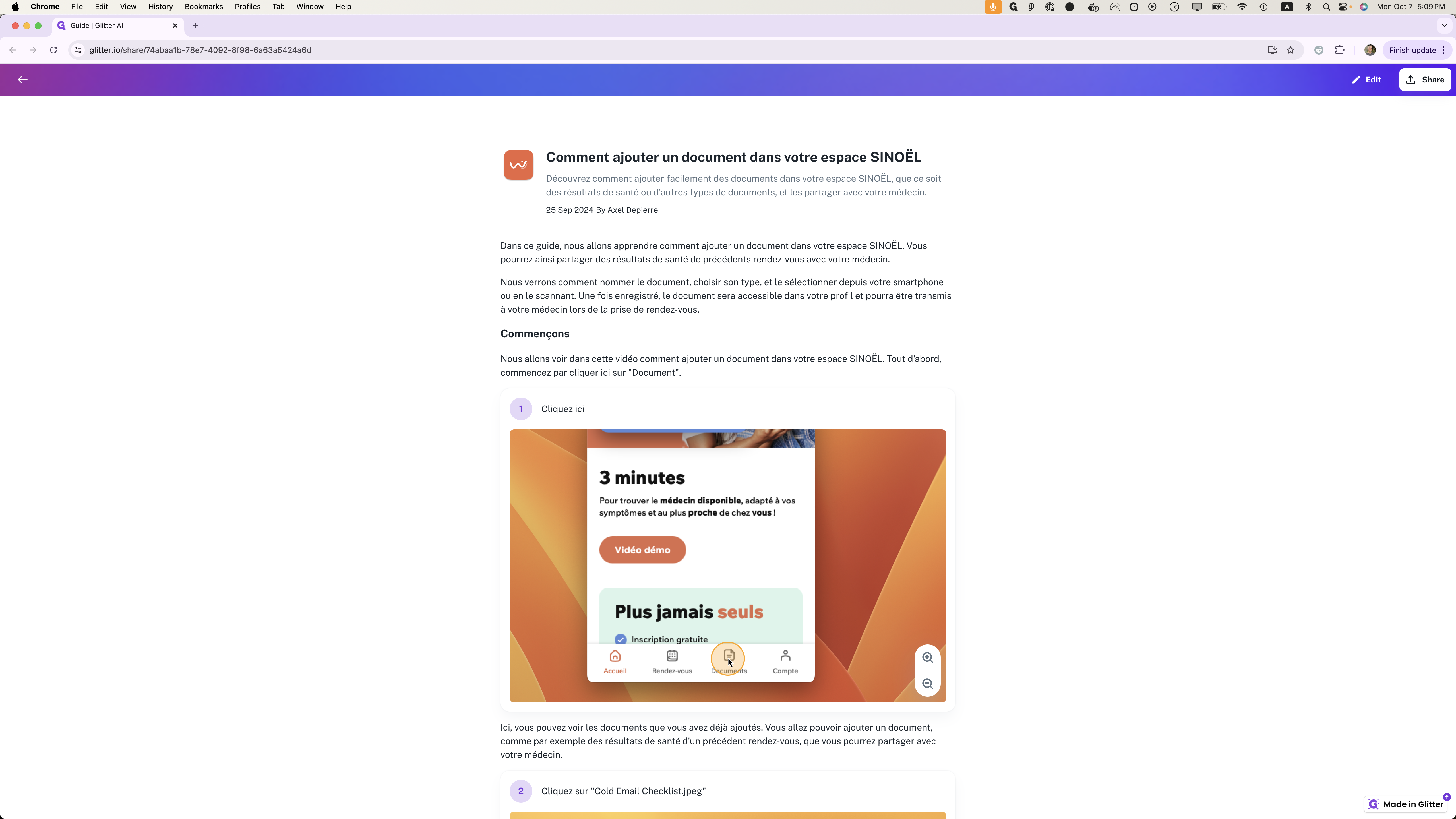Step #1: Click on "↑ Share"