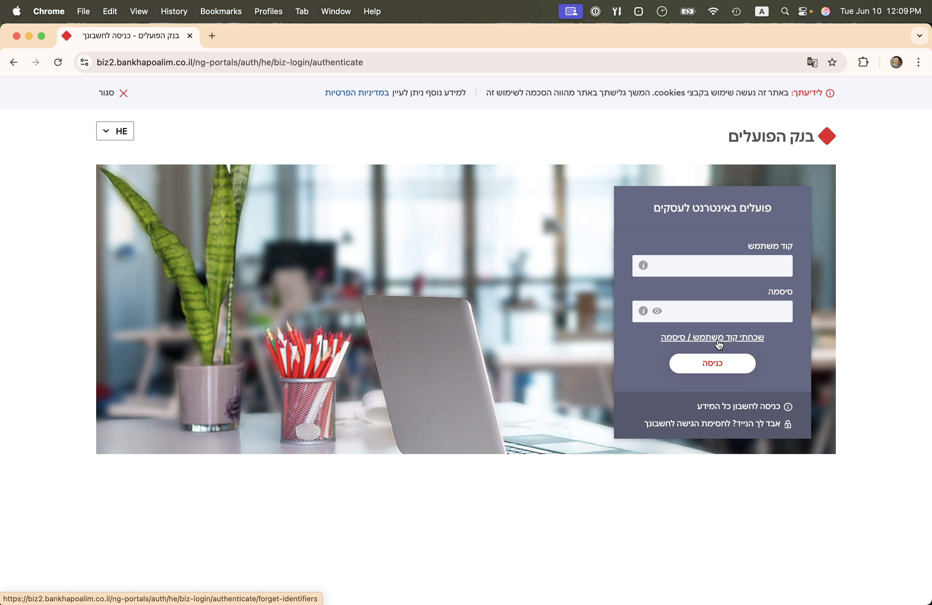 Step #2: לחצו על "שכחתי קוד משתמש / סיסמא"